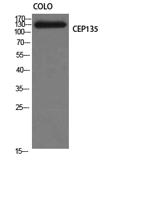 CEP135 Polyclonal Antibody