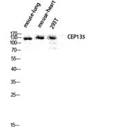 CEP135 Polyclonal Antibody