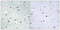 CEP135 Polyclonal Antibody