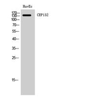 CEP152 Polyclonal Antibody