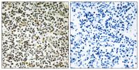 CEP152 Polyclonal Antibody