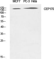 CEP170 Polyclonal Antibody