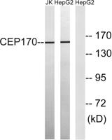 CEP170 Polyclonal Antibody