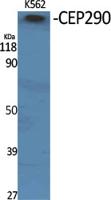 CEP290 Polyclonal Antibody