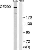 CEP290 Polyclonal Antibody