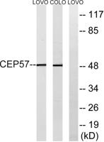 CEP57 Polyclonal Antibody