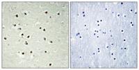 CEP70 Polyclonal Antibody