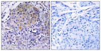 CEP78 Polyclonal Antibody