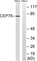 CEP78 Polyclonal Antibody