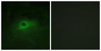 c-Fms Polyclonal Antibody