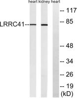 LRRC41 Polyclonal Antibody
