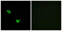 CHSY2 Polyclonal Antibody