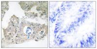 CIDE-3 Polyclonal Antibody