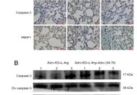 Cleaved-Caspase-3 p17 (D175) Polyclonal Antibody