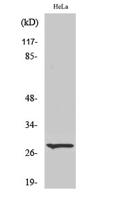 Cleaved-Integrin α6 LC (E942) Polyclonal Antibody