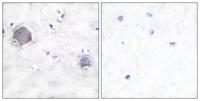 Cleaved-Notch 1 (V1754) Polyclonal Antibody