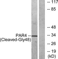 Cleaved-PAR-4 (G48) Polyclonal Antibody