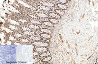 Cleaved-PARP-1 D214 Polyclonal Antibody