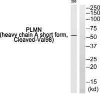 Cleaved-Plasminogen HC A short form (V98) Polyclonal Antibody