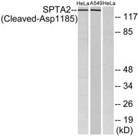 Cleaved-Spectrin α II (D1185) Polyclonal Antibody