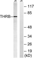 Cleaved-Thrombin APII (R327) Polyclonal Antibody