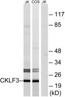 CMTM3 Polyclonal Antibody