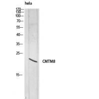 CMTM8 Polyclonal Antibody