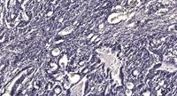 LPCAT2 Polyclonal Antibody