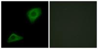 LPAAT-θ Polyclonal Antibody