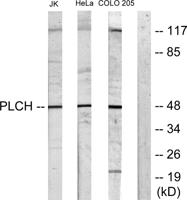 LPAAT-θ Polyclonal Antibody