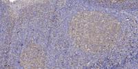 LPAAT-θ Polyclonal Antibody