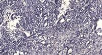 LPAAT-γ Polyclonal Antibody