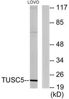 LOST1 Polyclonal Antibody