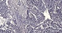 LOST1 Polyclonal Antibody