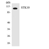 LOK Polyclonal Antibody