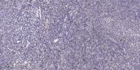LMX1B Polyclonal Antibody