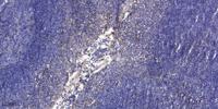 LMO4 Polyclonal Antibody