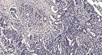 Liprin β1 Polyclonal Antibody