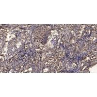 LIR-1 Polyclonal Antibody