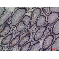 Lipocalin-1 Polyclonal Antibody