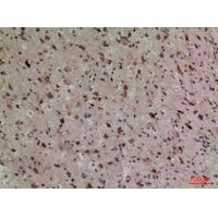 Lipocalin-1 Polyclonal Antibody
