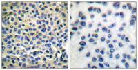 LIMK-1/2 Polyclonal Antibody