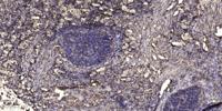 LIM and SH3 domain protein 1 Polyclonal Antibody
