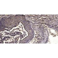 LIFR Polyclonal Antibody