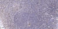 LHX1 Polyclonal Antibody