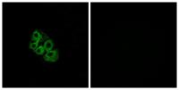 LHR Polyclonal Antibody