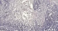 LHR Polyclonal Antibody