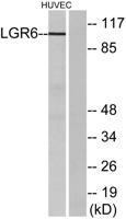 LGR6 Polyclonal Antibody