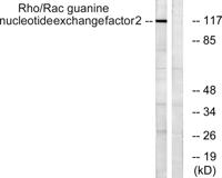Lfc Polyclonal Antibody