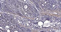 Lfc Polyclonal Antibody